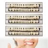 84Pcs False Teeth, Fake Teeth Dental Acrylic Resin Denture, Denture Repair Kit, 23 Shade A2 Upper + Lower Dental Materials for Replacement, for Missing Loose Tooth, 3 Sets, 23 A2 view 1
