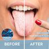 WUNDERHAUS 2 x Tongue Scraper for Adults, 100% Medical Grade 304 Stainless Steel, Includes Storage & Travel Cases, Hygienic & Safe Bad Breath Treatment, Metal Cleaners for Oral Health, Pack of 2 view 2