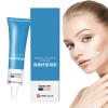 Bexdug Scar Removal Cream - 20g Old Scars Repair Gel | New & Burn Scar Gel - Not Greasy, Waterproof with Moisturizing Effect for The Whole Body view 1