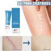 Bexdug Scar Removal Cream - 20g Old Scars Repair Gel | New & Burn Scar Gel - Not Greasy, Waterproof with Moisturizing Effect for The Whole Body view 3