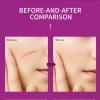 Bexdug Scar Removal Cream - 20g Old Scars Repair Gel | New & Burn Scar Gel - Not Greasy, Waterproof with Moisturizing Effect for The Whole Body view 4
