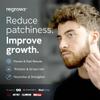 Regrowz Beard Oil for Men 2x 30ml  Nourishing Beard Growth Serum with Coconut & Jojoba Oils  Hydrates, Softens & Relieves Itchy Beards  Promotes Thicker, Fuller Beard  Beard Oil For Men Growth view 3