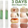 5Pcs Genital Wart Treatment Papillomas Removal Warts Liquid Remove 3ml view 2