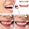 Dazzluxe 2 Pairs Instant Veneers Dentures, Clip in Veneers Teeth Top And Bottom, Snap on Veneers Teeth Fake Teeth, Cosmetic False Teeth Whitening Veneers for Cover Imperfect Teeth view 3