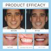 Holibao Silicone Reline Denture Set, Soft Denture Silicone Reline Kit, Snap in Teeth Teeth Comfort Fit (2) view 4