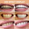 Dazzluxe 2 Pairs False Teeth Veneers, Snap on Teeth Veneers Top And Bottom, Instant Teeth Whitening Kits, Adjustable Temporary Clip in Dentures for Men Women view 3