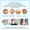 2 Pcs Teeth Whitening Pen - Gentle, Fast & Effective Tooth Stain Removal view 2