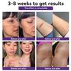 Advanced Scar Gel, Bump Removal, Scar Cream, Scar Removal Cream, Removal Cream, Bump Treatment, Scar Cream For Surgical Scars (3PCS) view 3