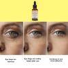 Vitamin C Face Vitamin C Vitamin E Face Face With Vitamin C 30ML NSj42 (Grey, 3.8x3.8x10.8cm) view 2