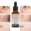 Vitamin C Face Vitamin C Vitamin E Face Face With Vitamin C 30ML NSj42 (Grey, 3.8x3.8x10.8cm) view 4