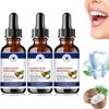 Coconut Fresh Oil-Pulling Mouthwash, Coconut Pulling Oil for Teeth, Coconut Mint Mouthwash, Coconut Oil Pulling for Teeth, Fresh Breath (3) view 1