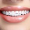 Tooth Gem Kit | Teeth Gems Jewelry - Tooth Gems Kit Shining Teeth Gems Gemstone Style Tooth Jewelry Kit Fashionable Crystal Tooth Ornaments view 3