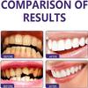 Purple Toothpaste for Teeth Whitening,Purple Toothpaste for Sensitive Teeth Whitening,Tooth Stain Removal Colour Corrector,Fresh Breath,Purple Toothpaste Whitening (1 pcs) view 3