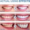Purple Toothpaste for Teeth Whitening, Purple Whitening Toothpaste, Whitening Probiotic Toothpaste, Colour Corrector Toothpaste, Stain Removal, Fresh Breath (1) view 4