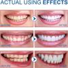 SP-6 Probiotic Ultra Whitening Toothpaste, Sp-6 Ultra Whitening Toothpaste, Sp-6 Toothpaste Probiotic, Sp6 Toothpaste, Probiotics Bright White Toothpaste, Fresh Breath (2pcs) view 2