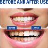 Sp-8 Probiotics Whitening Toothpaste, Sp-8 Probiotic Toothpaste, Sp 8 Probiotic Toothpaste Whitening, Sp8 Toothpaste, Sp-8 Toothpaste Ultra Whitening Toothpaste Fresh Breath (1pcs) view 3