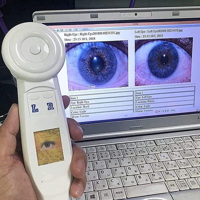 5.0 MP USB Iris Analyzer Iridology Camera,Iris Analysis Camera, with HD 30x Iris Lens USB Left/Right Lamp Analyzer/Analysis Iridology Camera with Pro Iris Software