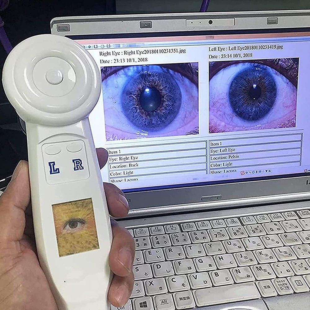 5.0 MP USB Iris Analyzer Iridology Camera,Iris Analysis Camera, with HD 30x Iris Lens USB Left/Right Lamp Analyzer/Analysis Iridology Camera with Pro Iris Software