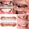 False Teeth Veneers Top and Bottom Veneers Fake Teeth Temporary Prosthesis Teeth for Men Women Silicone Dental Prostheses for Protecting Teeth Regaining Smile,6pcs view 3