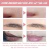 2PCS Gentle Facial Hair Removal Cream Kit - Moisturizing Painless Upper Lip Face Treatment for Women view 2