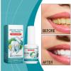 Tooth Paint, Tooth White Paint Kit, Instant Teeth Whitening Gel Coating, Easy and Fast Shiny Teeth, Confident Social (1) view 2