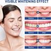 Tooth Paint Kit, Instant Teeth Whitening Paint (2pcs) view 3