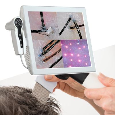 15 Inch Screen Scalp Analyzer Machine Hair, With Divided Into 4 Screens Comparison,Can Freeze Frame Image And Storing Pictures,220V