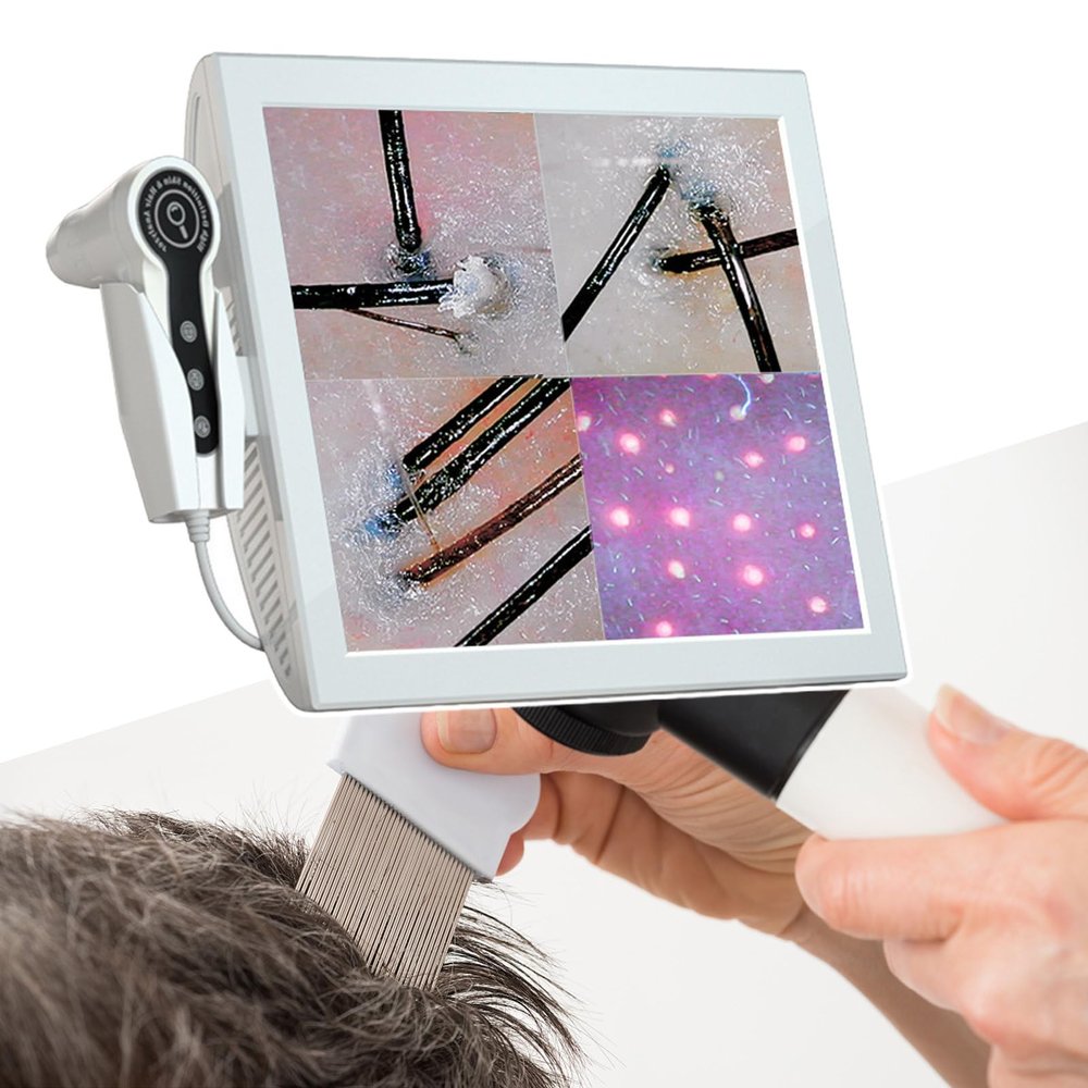 15 Inch Screen Scalp Analyzer Machine Hair, With Divided Into 4 Screens Comparison,Can Freeze Frame Image And Storing Pictures,220V