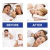 30 Pieces Anti Anti Snore Breakout Adhesive Sleeping Tape for Less Snoring Snoring, Advanced Adhesive Tape for Better Sleep, Prevent and view 4