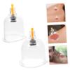 FOMIYES 6pcs Reusable Cupping Cups Plastic Cupping Devices for Traditional Therapy Convenient Vacuum Suction Cups for Beauty Tools and Home Use view 3