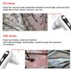 Skin Diagnosis Hair Analyzer, Skin Detector Tester Hair Skin Analyzer Machine Skin Pigment Tester, Skin and Hair Detection Hair Follicle Detector 50x/200x DualHeads Skin Scalp Detector view 4