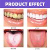 Pro-Biotic Oral Spray,Pro-Biotic Breath Spray,Mouth Spray,Breath Freshener Spray,Bad Breath Treatment for Adults,Fresh Breath Spray for Bad Breath,Long-Lasting Mouth Freshener Spray,Dry Mouth Spray view 2