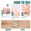 Scar Cream for Men and Women,Scar Removal Cream,Scar Repair Cream,Skin Smoothing Firming and Fading, Skin Scar Removal Repair,Advance Scar Gel Away Gel for Surgical Scars (1) view 4