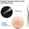 Blackhead Tweezers Blackhead Remover Facial Blackhead Remover for Women Professional Tools 3 in 1 Stainless Steel (1 Set) view 3