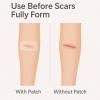 10 x Clear Scar Sheets, Skin Patches for Face and Body, Prevention and Reduce Scars from Scalds, Burns, Cuts and Abrasions, Thin view 3