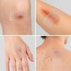 10 x Clear Scar Sheets, Skin Patches for Face and Body, Prevention and Reduce Scars from Scalds, Burns, Cuts and Abrasions, Thin view 4