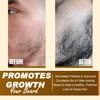 DD Teck Beard Oil with Coconut Oil Easily Absorbed Conditioning Oil for Beard, Skin & Face, Softens, Hydrates & Strengthens Facial Hair, Reduces Dryness & Itching, Enhances Shine (500ml Pump) view 3