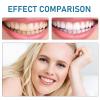 Care Spring Clip in Veneers Teeth Moldable False Teeth 2 Pairs Instant Veneers Dentures, Missing Tooth Replacement Kit Top And Bottom, Cosmetic Teeth Veneers Temporary Tooth for Men Women view 4