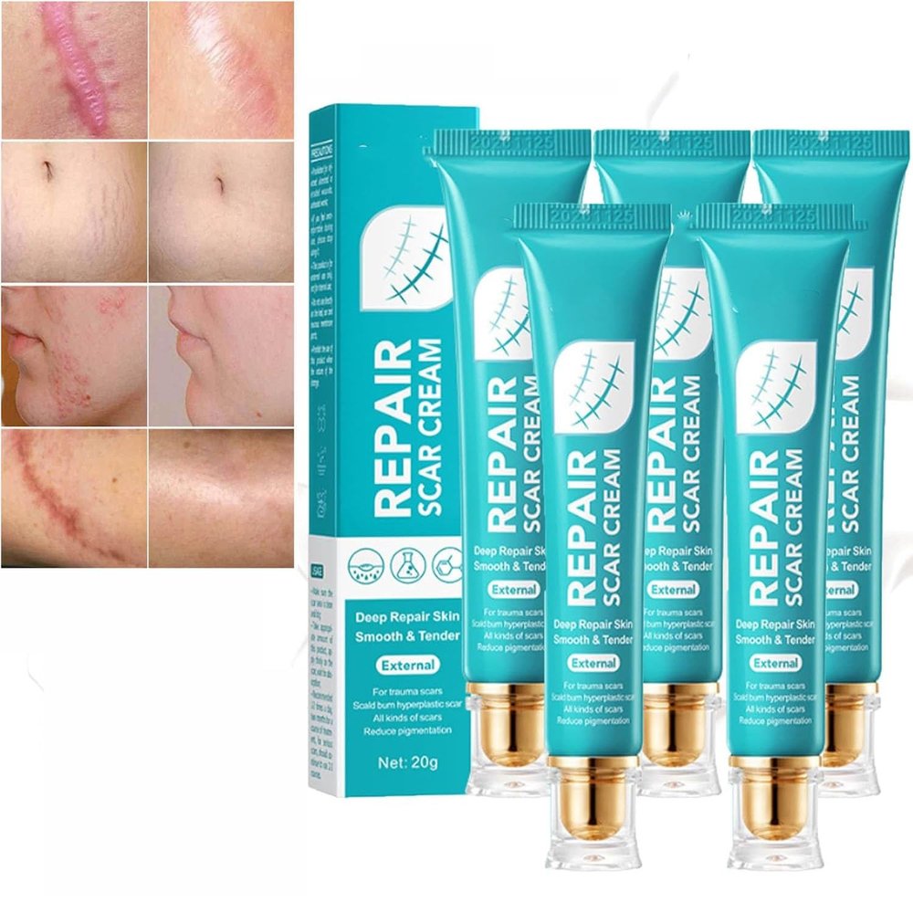 Scar Repair Cream,Repair Scar Cream,Advance Scar Gel,Scar Healing Cream,Scar Remover Cream,Scar Removal Cream for Skin Scar Removal Repair (5 Pcs)