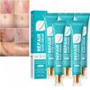 Scar Repair Cream,Repair Scar Cream,Advance Scar Gel,Scar Healing Cream,Scar Remover Cream,Scar Removal Cream for Skin Scar Removal Repair (5 Pcs) view 1