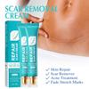 Scar Repair Cream,Repair Scar Cream,Advance Scar Gel,Scar Healing Cream,Scar Remover Cream,Scar Removal Cream for Skin Scar Removal Repair (5 Pcs) view 2