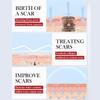 Scar Repair Cream,Repair Scar Cream,Advance Scar Gel,Scar Healing Cream,Scar Remover Cream,Scar Removal Cream for Skin Scar Removal Repair (5 Pcs) view 4