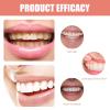 Care Spring False Teeth Veneers 2 Pairs Silicone Reline Denture Set Upper And Lower, Instant Veneers Dentures Ultra Thin Flex Design, Temporary Tooth Filling Natural White for Men & Women view 3
