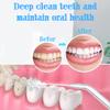 Water Flosser Dental Irrigator Tap Oral Irrigator No Batteries and No Electricity for Oral Cleaning and Braces Care(White 2) view 3
