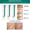Botanical Scar Care Cream - Advanced Formula for Smoothing Skin Texture, Fades the Appearance of Old & New Scars, Intensive Care for Stretch Marks & Blemishes, Gentle for Face & Body view 2