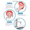 Oral Cleanser Tool - Metal Tongue Splits - Scraper for Adults | Stainless Steel - Resistance Strams | The Scraps of the Tongue with Fans Non Slip Portable for Det view 3