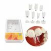 10 pcs/pack Dental Clear Matrix Anterior PosteriorFit Bioclear BT Transparent Matrices Teeth Molar Bow Class Restoration Black Triangle (B2 Wide Distal Anterior Matrix) view 3