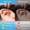 Ear Spoon Tips Silicone Ear Wax Removal Replacement Tips for Ear Camera Ear Wax Removal Endoscope (Blue, 60 Pcs) view 4