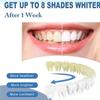2025 New Mullend Teeth Repair Gel, Mullend Gum Repair Gel, Natural Toothpaste Treatment, Protect Gums & Oral Care,Deeply Cleaning Gums, Teeth Essence Pen, Mullein Teeths Repairs Gels, Fresh Breath (1) view 2