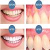 2025 New Mullend Teeth Repair Gel, Mullend Gum Repair Gel, Natural Toothpaste Treatment, Protect Gums & Oral Care,Deeply Cleaning Gums, Teeth Essence Pen, Mullein Teeths Repairs Gels, Fresh Breath (1) view 4